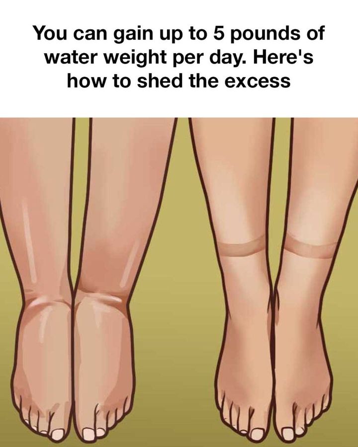 Understanding Water Weight and Its Causes