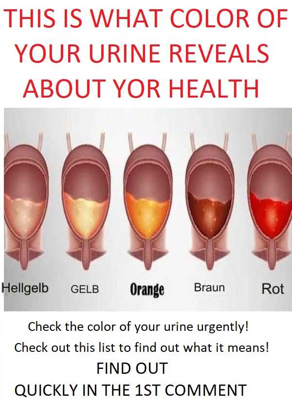 What You Should Know: The Color of Your Urine Determines Your Kidney Health